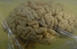 Ученые разрезали замороженный мозг Молейсона