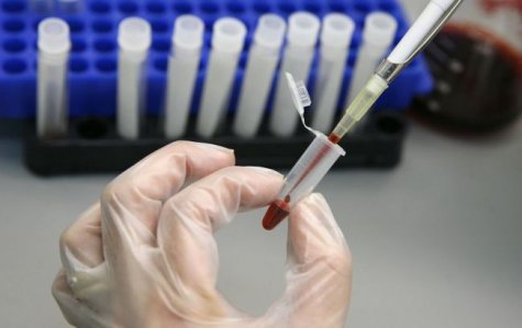 Количество случаев заболевания гепатитом А в Киеве возросло на треть