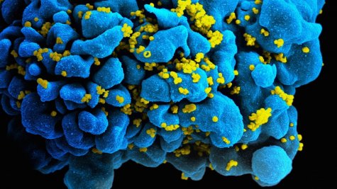 Немецкие ученые смогли победить ВИЧ