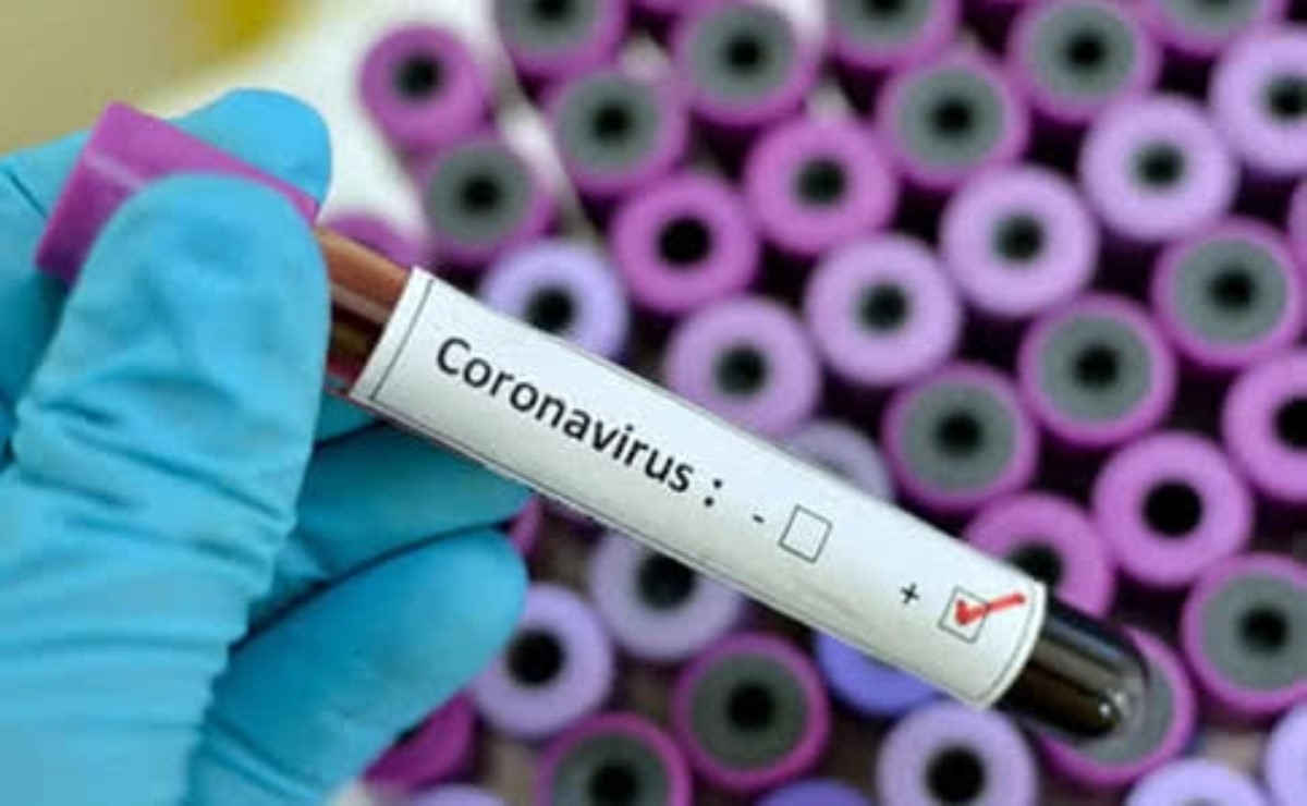 Коронавирус выявляют лишь у одного из 10 зараженных - исследование