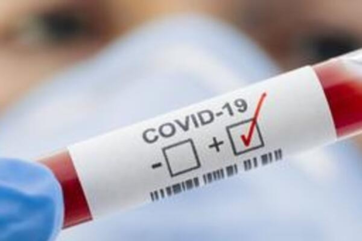 Медики объяснили разницу между экспресс-тестами на коронавирус и ПЦР-диагностикой