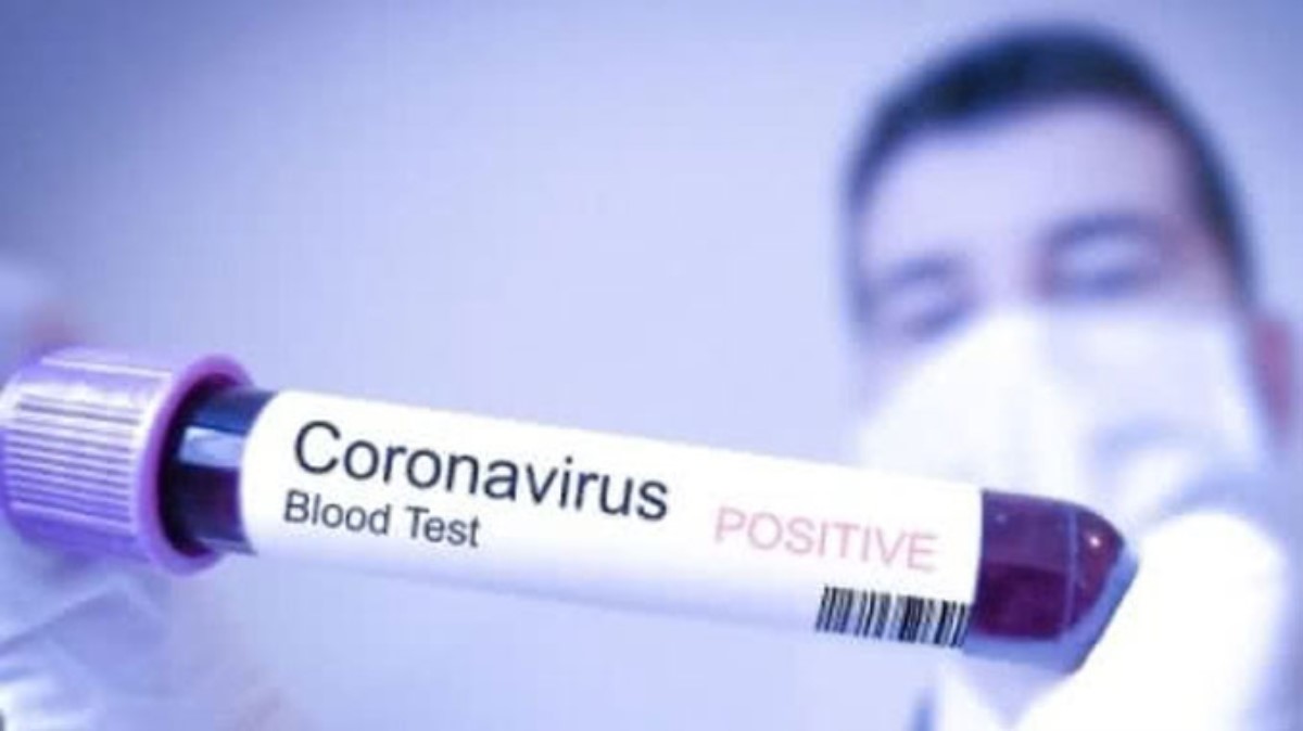 В Минздраве объяснили, что делать если в вашем доме есть инфицированный коронавирусом