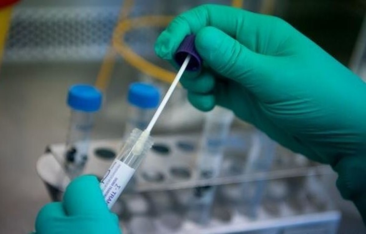 Эксперты раскрыли правду о быстрых тестах на коронавирус