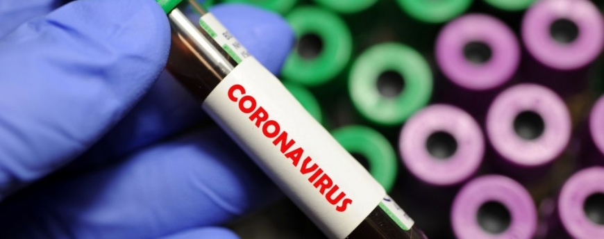 Что может повысить риск смерти от коронавируса: перечень болезней