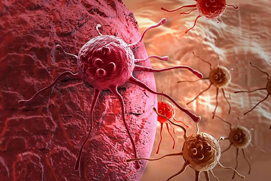 Ученые разработали необычный способ диагностики рака