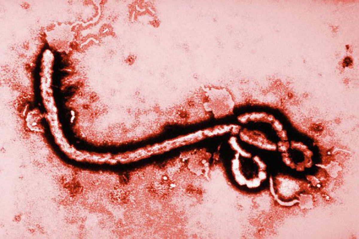 Экспериментальная вакцина не помогла спасти больного лихорадкой Эбола