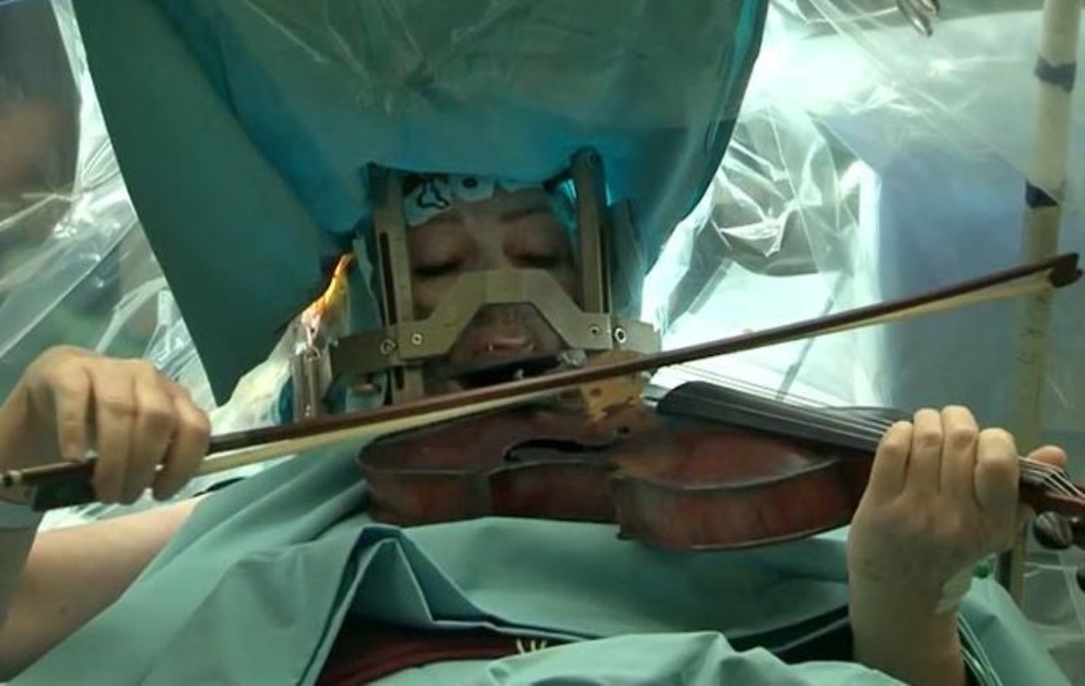 Литовская скрипачка играла «классику» во время операции на мозге