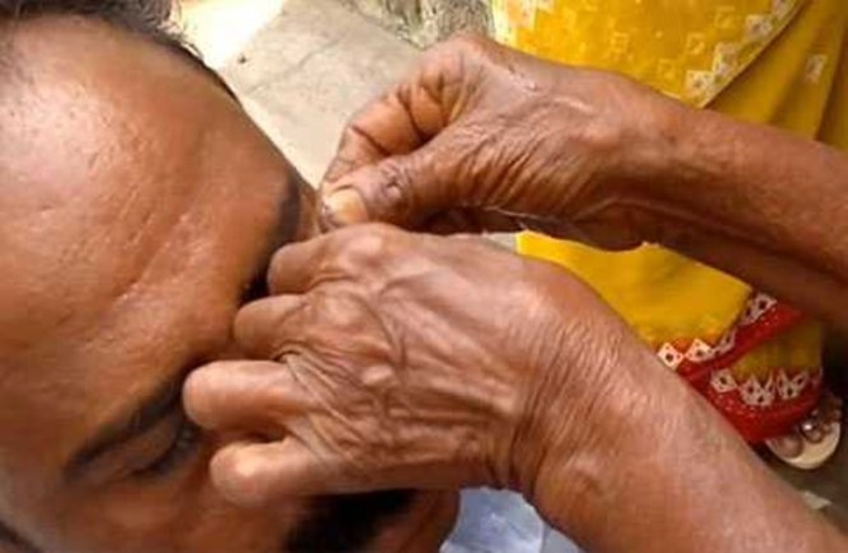 В Индии старушка вилкой вытаскивает из глаз песок и песок
