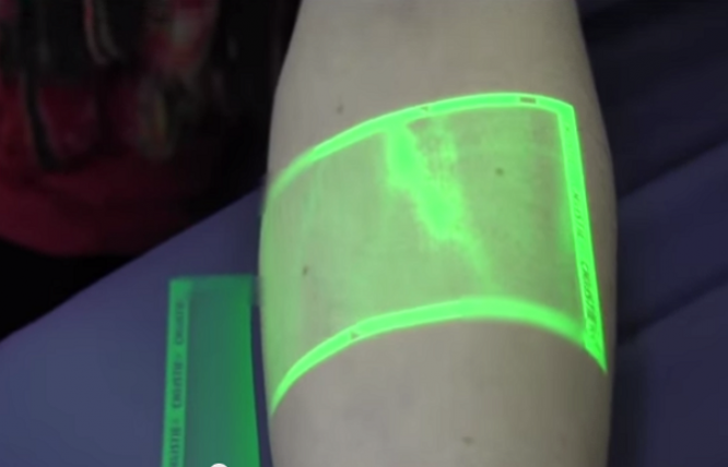 Создано устройство, позволяющее видеть вены под кожей