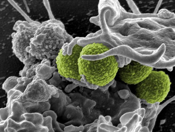 Ученые нашли замену антибиотикам в наночастицах