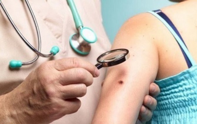 Украинцы смогут бесплатно провериться на рак кожи