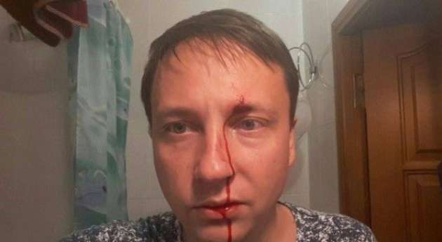 В Черноморске избили депутата
