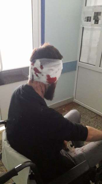 "Добивали ногами": в Харькове жестоко избили депутата