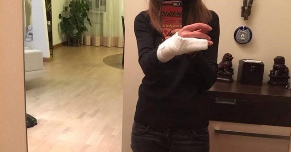 В Киеве женщине-водителю за отказ предъявить документы копы повредили пальцы
