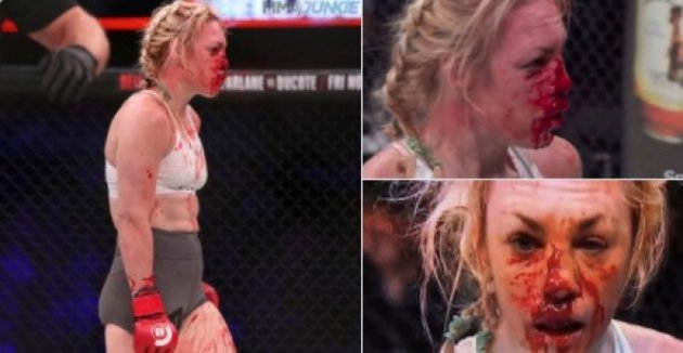Кровавая ванна. Девушке-бойцу MMA разбили лицо, превратив его в месиво