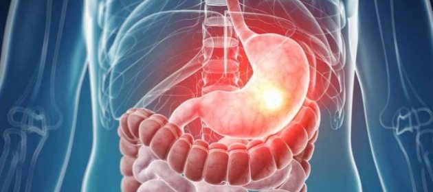 Инфаркт и рак: препараты для лечения желудка признали опасными для жизни
