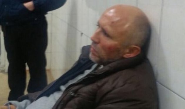 Владельца "Житомирской кондитерской фабрики" арестовали и избили по дороге в СИЗО