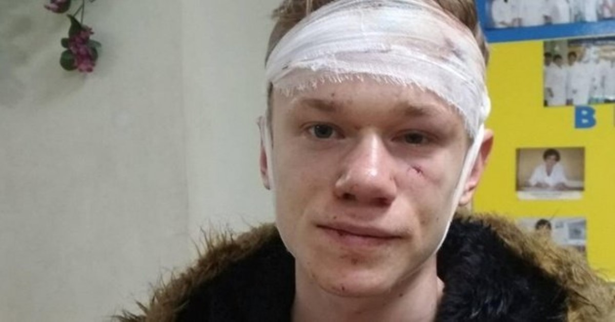 Избитые в центре Киева парни: "Мы слышали, как полицейские попросили молодчиков: "Только без фанатизма"