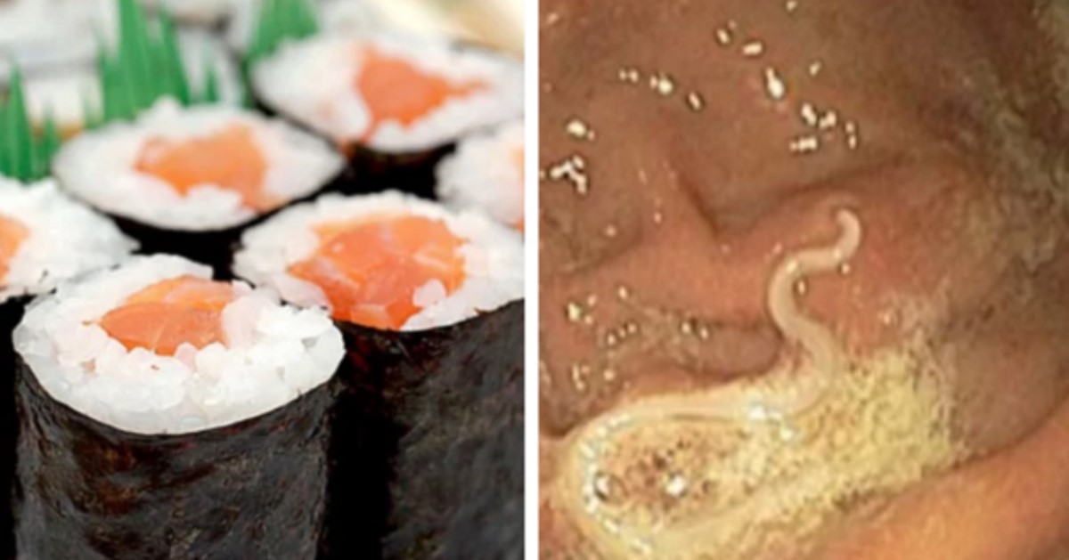 Любите суши? Эти опасные черви, вероятно, внутри вас