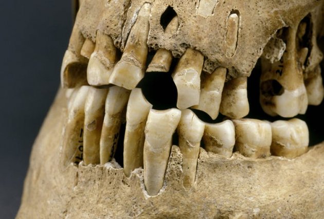 Сахар невиновен: у наших древних предков были такие же проблемы с зубами
