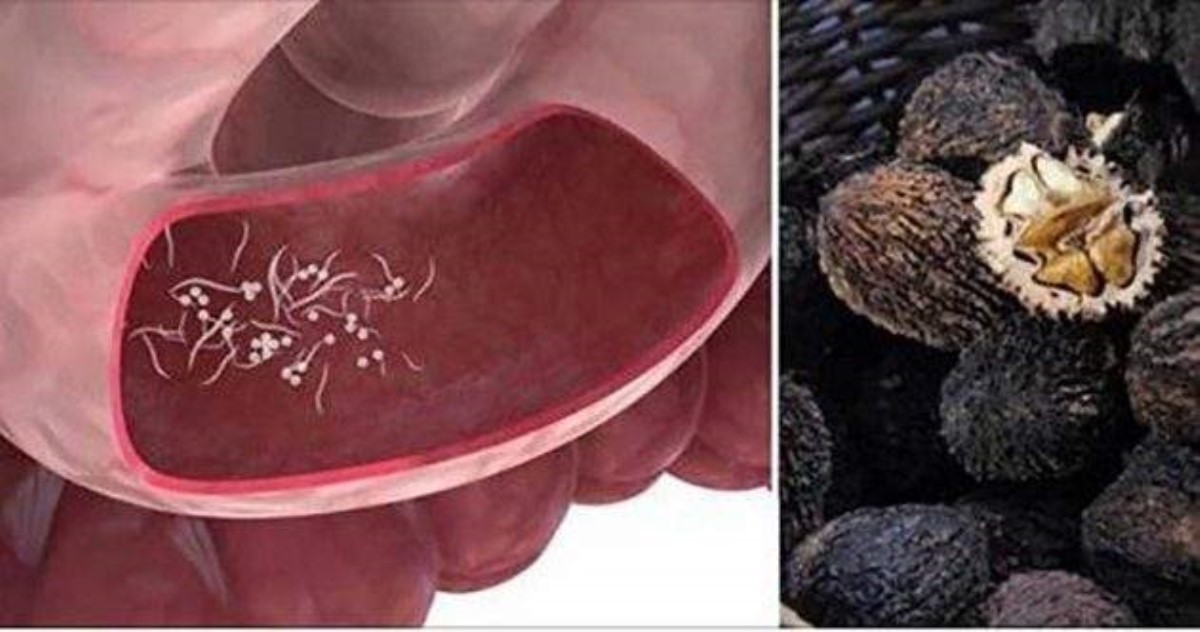 10 симптомов паразитов и 7 продуктов для их удаления