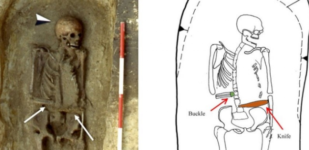 В Италии нашли скелет с протезом-ножом вместо руки