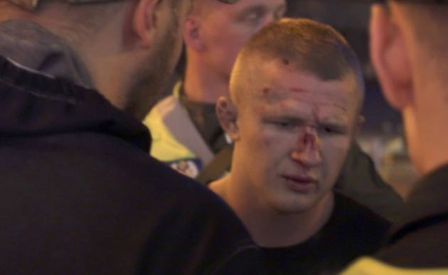 Это нормально для цивилизованной страны: Шкиряк не видит ничего страшного в избиении иностранцев на улицах Киева