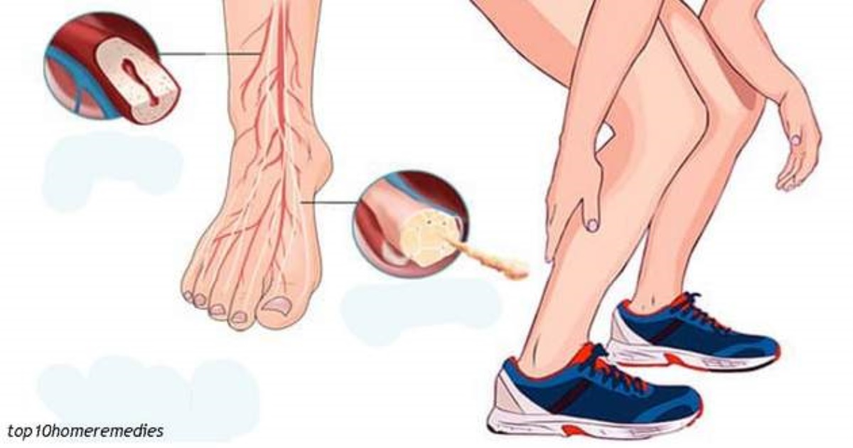 Как быстро остановить судороги ног