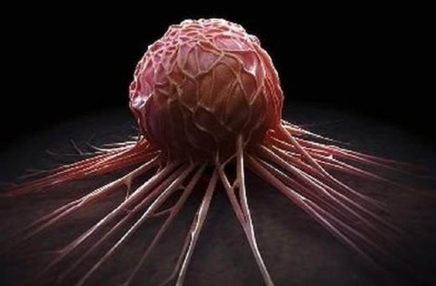Ученые назвали простой способ спастись от рака