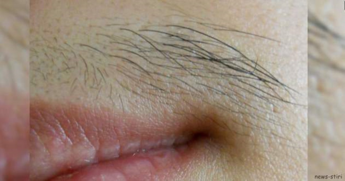 От ненавистных ″усиков″ можно избавиться буквально за 5 минут: вот что надо делать