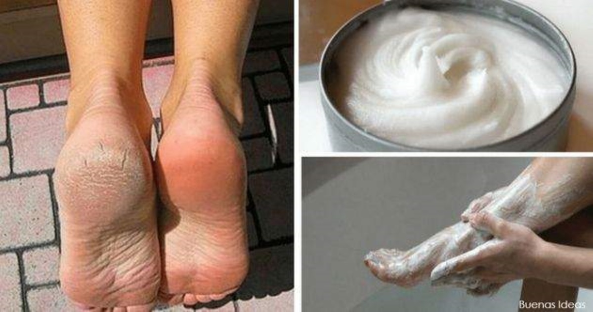 7 лучших вещей, которые вы можете сделать для красоты своих ног