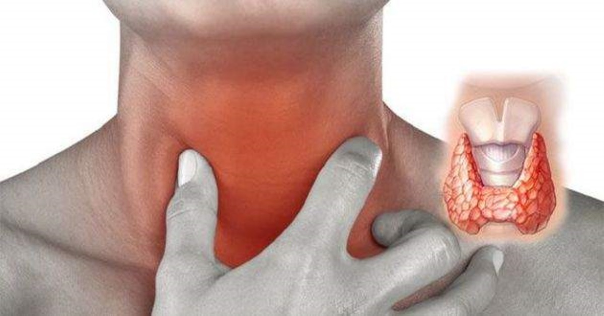 Лечим щитовидку: 2 стакана - и симптомы воспаления испарятся
