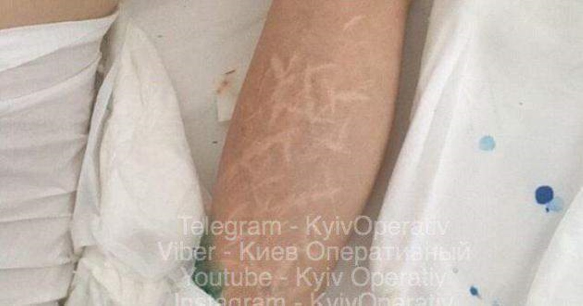 Рухнула с высоты: в Киеве нашли искалеченную женщину с татуировкой