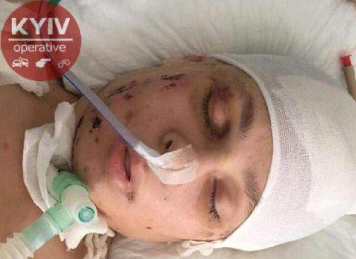 ​В Киеве не могут опознать найденную без сознания молодую девушку