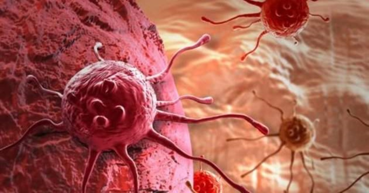 Рак может самоуничтожиться: ученые сделали прорыв в лечении