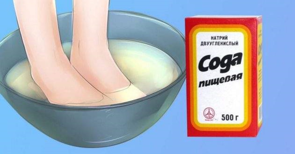 Для ног, волос и против нагара на сковороде: где пригодится сода
