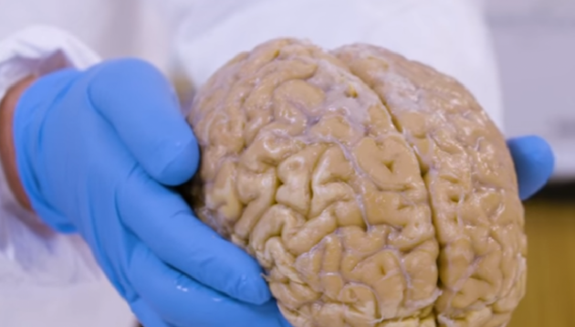 Ученые обнаружили неожиданную особенность женского мозга