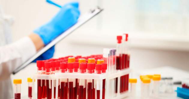 Как самостоятельно расшифровать анализ крови