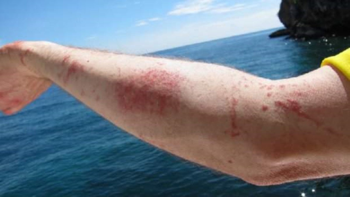 Популярный курорт Украины атаковали медузы. Видео