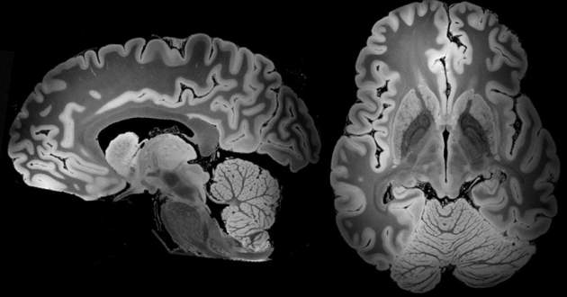 МРТ на 100 часов: подробные изображения мозга человека