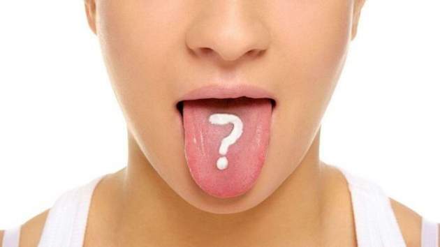 Медики рассказали, о каких симптомах говорит белый налет на языке