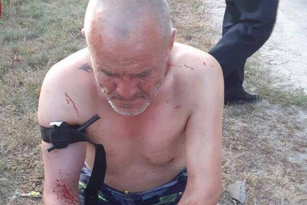В Киеве пьянка закончилась кровавыми разборками на ножах