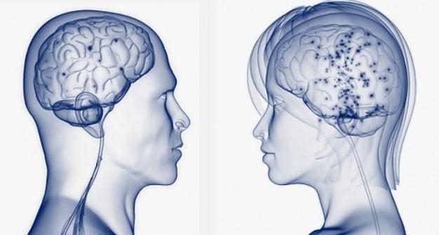 Названы 20 основных отличий мужского и женского мозга
