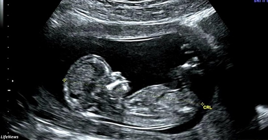 С какой недели нерождённые дети чувствуют боль от аборта