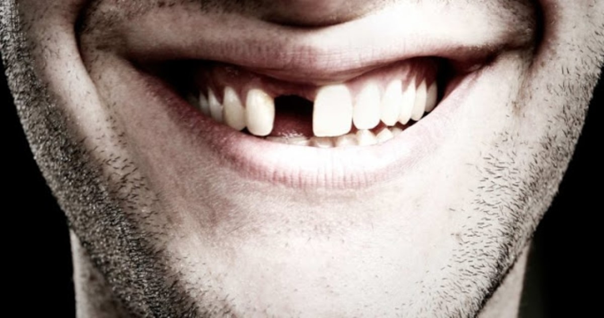 Количество выпавших зубов поможет определить оставшуюся продолжительность жизни человека