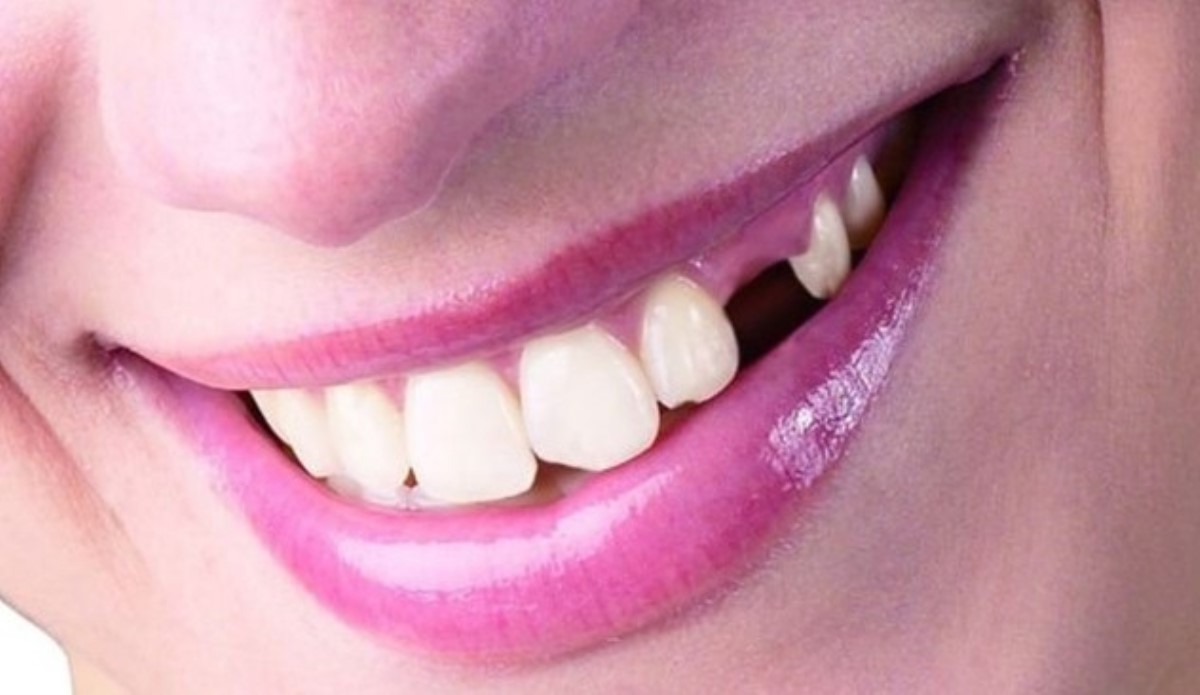 Как понять по зубам человека, сколько он проживет