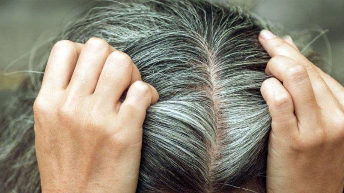Ученые выяснили, почему седеют волосы после стресса