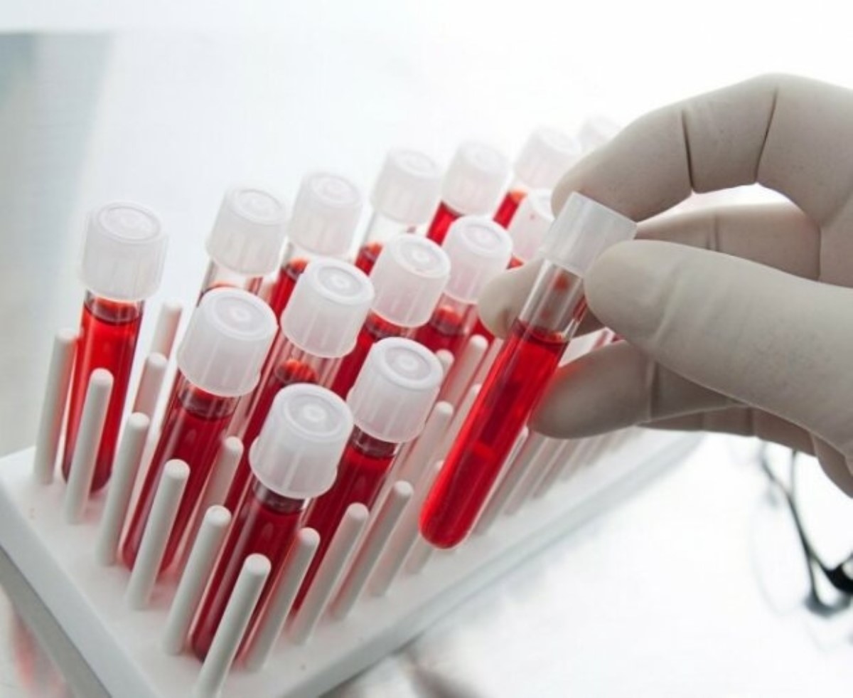 Как расшифровать анализ крови: врачебные тайны