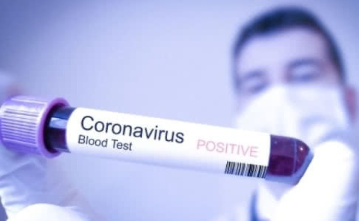 Ученый напугал прогнозом о коронавирусе