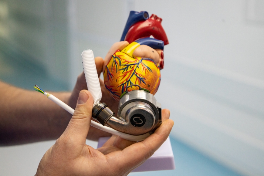 В городской больнице Киева впервые провели операцию по имплантации механического сердца